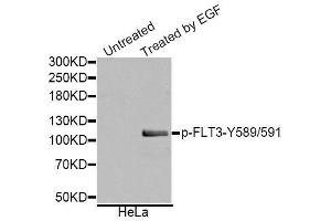 Western blot analysis of extracts of various cell lines, using Phospho-FLT3-Y589/591 antibody (ABIN5995603). (FLT3 抗体  (pTyr589, pTyr591))