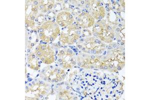 Immunohistochemistry of paraffin-embedded mouse kidney using HARS2 antibody at dilution of 1:100 (x40 lens). (HARS2 抗体)