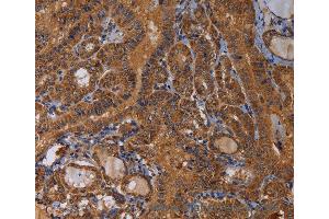 Immunohistochemistry of Human brain  using MAGEB10 Polyclonal Antibody at dilution of 1:60 (MAGEB10 抗体)