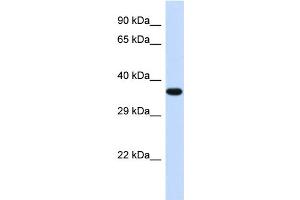 Western Blotting (WB) image for anti-Transducer of ERBB2, 2 (TOB2) (Middle Region) antibody (ABIN2500516) (TOB2 抗体  (Middle Region))