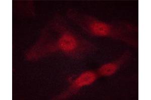 ABIN6267513 staining HeLa cells by ICC/IF. (STAT5 A/B 抗体  (pSer725, pSer730))