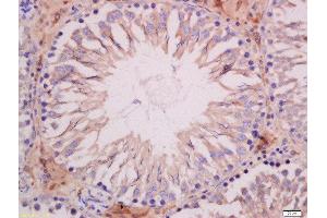 Formalin-fixed and paraffin embedded rat testis tissue labeled with Anti-SOAT1 Polyclonal Antibody, Unconjugated 1:400 followed by conjugation to the secondary antibody and DAB staining (SOAT1 抗体  (AA 51-150))