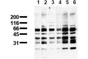 Western Blotting (WB) image for anti-Phosphoserine (phosphorylated) antibody (ABIN126861) (Phosphoserine 抗体  (phosphorylated))