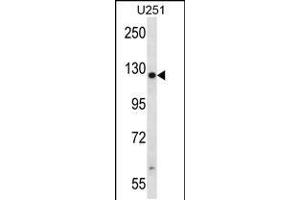 Western blot analysis in U251 cell line lysates (35ug/lane). (TTC13 抗体  (N-Term))
