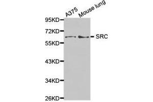 Western Blotting (WB) image for anti-Proto-oncogene tyrosine-protein kinase Src (Src) antibody (ABIN1874936) (Src 抗体)