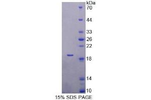 SDS-PAGE (SDS) image for Tubulin Folding Cofactor A (TBCA) (AA 2-108) protein (His tag) (ABIN6239023) (TBCA Protein (AA 2-108) (His tag))