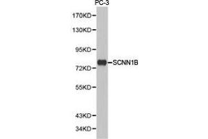 Western Blotting (WB) image for anti-Sodium Channel, Nonvoltage-Gated 1, beta (SCNN1B) antibody (ABIN1874704) (SCNN1B 抗体)