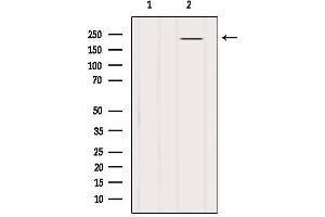 Western blot analysis of extracts from B16F10, using BRCA1 Antibody. (BRCA1 抗体  (Internal Region))