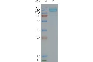 Human -Nanodisc, Flag Tag on SDS-PAGE (GRM7 蛋白)