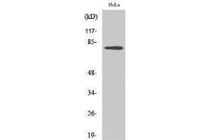 Western Blotting (WB) image for anti-Bruton Agammaglobulinemia tyrosine Kinase (BTK) (pTyr551) antibody (ABIN3182187) (BTK 抗体  (pTyr551))