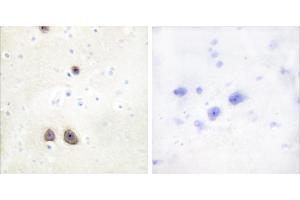 Peptide - + (RBM39 抗体  (Internal Region))