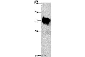 Western blot analysis of Mouse brain tissue, using SYN1 Polyclonal Antibody at dilution of 1:750 (SYN1 抗体)