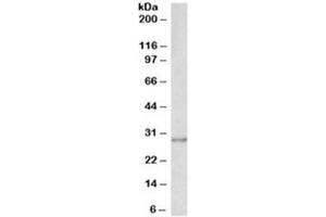 Western blot testing of A431 lysate with SNAIL antibody at 0. (SNAIL 抗体)