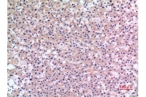 Immunohistochemical analysis of paraffin-embedded human-liver, antibody was diluted at 1:100. (CMTM6 抗体  (C-Term))