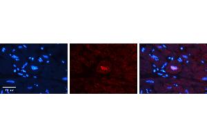 Rabbit Anti-JUNB Antibody   Formalin Fixed Paraffin Embedded Tissue: Human heart Tissue Observed Staining: Nucleus Primary Antibody Concentration: 1:100 Other Working Concentrations: N/A Secondary Antibody: Donkey anti-Rabbit-Cy3 Secondary Antibody Concentration: 1:200 Magnification: 20X Exposure Time: 0. (JunB 抗体  (N-Term))