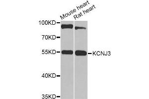 Western blot analysis of extracts of various cell lines, using KCNJ3 Antibody (ABIN6003556) at 1/1000 dilution. (KCNJ3 抗体)