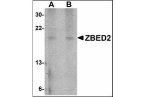 Western blot analysis of ZBED2 in A549 cell lysate with ZBED2 antibody at (A) 1 and (B) 2 µg/ml. (ZBED2 抗体  (N-Term))