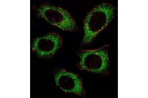 Fluorescent ige of  cell stained with P2K2 Antibody  (ABIN6243254 and ABIN6579024)/SA080220AJ. (MEK2 抗体  (AA 372-400))