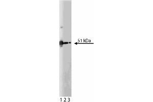 Western blot analysis of PKA[RIIalpha] on K562 lysate. (PKA RIIalpha (AA 1-404) 抗体)