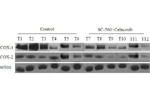 Western Blotting (WB) image for anti-Prostaglandin-Endoperoxide Synthase 2 (Prostaglandin G/H Synthase and Cyclooxygenase) (PTGS2) (AA 501-604) antibody (ABIN672471)