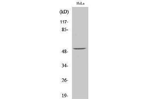 Western Blotting (WB) image for anti-Activating Transcription Factor 2 (ATF2) (pSer62) antibody (ABIN3179390) (ATF2 抗体  (pSer62))