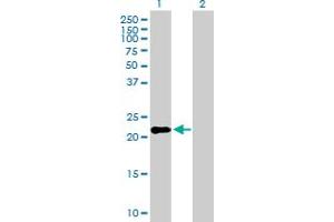 Western Blot analysis of IFNK expression in transfected 293T cell line by IFNK MaxPab polyclonal antibody. (IFNK 抗体  (AA 1-207))