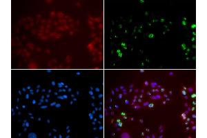 Immunofluorescence analysis of GFP-RNF168 transgenic U2OS cell using XPA antibody. (XPA 抗体)