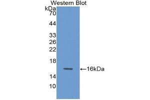 Detection of Recombinant GDF15, Rat using Polyclonal Antibody to Growth Differentiation Factor 15 (GDF15) (GDF15 抗体  (AA 189-303))