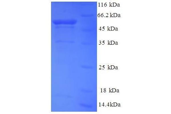 Myosin 9 Protein (MYH9) (AA 2-241, partial) (GST tag)