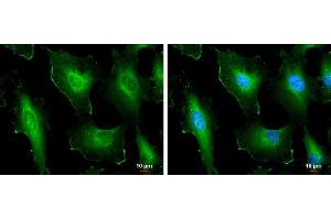 Immunofluorescence (IF) image for anti-Cortactin (CTTN) (N-Term) antibody (ABIN2854674)