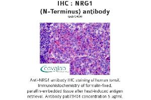 Image no. 1 for anti-Neuregulin 1 (NRG1) (Isoform 10) antibody (ABIN1737529) (Neuregulin 1 抗体  (Isoform 10))