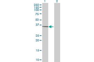 Western Blotting (WB) image for SFTPB 293T Cell Transient Overexpression Lysate(Denatured) (ABIN1333456)