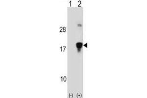 Western Blotting (WB) image for anti-High Mobility Group Nucleosomal Binding Domain 3 (HMGN3) antibody (ABIN2999006) (HMGN3 抗体)