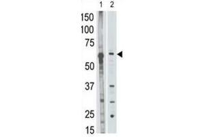 Western Blotting (WB) image for anti-Matrix Metallopeptidase 25 (MMP25) antibody (ABIN5022339) (MMP25 抗体)