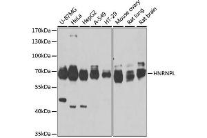 Western blot analysis of extracts of various cell lines, using HNRNPL antibody. (HNRNPL 抗体)