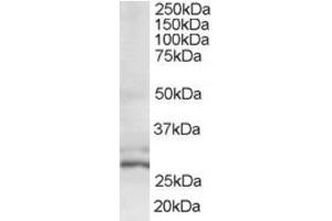 Western Blotting (WB) image for anti-HIV-1 Tat Interactive Protein 2, 30kDa (HTATIP2) (N-Term) antibody (ABIN2466379) (HIV-1 Tat Interactive Protein 2, 30kDa (HTATIP2) (N-Term) 抗体)