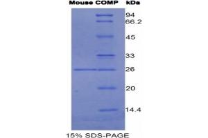 SDS-PAGE analysis of Mouse COMP Protein. (COMP 蛋白)