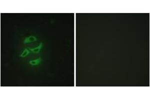 Immunofluorescence (IF) image for anti-Cytochrome P450, Family 2, Subfamily J, Polypeptide 2 (CYP2J2) (AA 231-280) antibody (ABIN2889947) (CYP2J2 抗体  (AA 231-280))