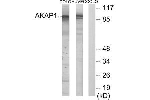 Western blot analysis of extracts from HUVEC cells and COLO cells, using AKAP1 antibody. (AKAP1 抗体  (Internal Region))
