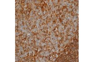 Immunohistochemistry (IHC) image for anti-CD44 (CD44) antibody (ABIN180800) (CD44 抗体)