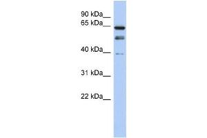 Western Blotting (WB) image for anti-MYST Histone Acetyltransferase 2 (MYST2) antibody (ABIN2457900) (MYST2 抗体)