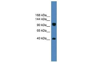 WB Suggested Anti-CNTN1 Antibody Titration: 0. (Contactin 1 抗体  (Middle Region))