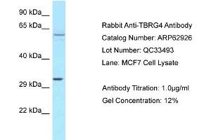 Western Blotting (WB) image for anti-Transforming Growth Factor beta Regulator 4 (TBRG4) (C-Term) antibody (ABIN971852) (TBRG4 抗体  (C-Term))