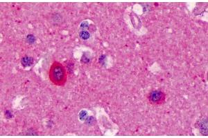 Immunohistochemistry (IHC) image for anti-Nitric Oxide Synthase 1, Neuronal (NOS1) (C-Term) antibody (ABIN184662)