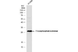 WB Image Triosephosphate isomerase antibody detects Triosephosphate isomerase protein by western blot analysis. (TPI1 抗体  (C-Term))