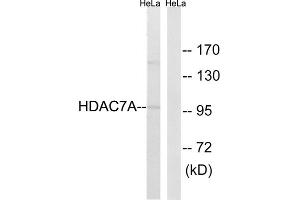 Western blot analysis of extracts from HeLa cells, using HDAC7A (epitope around residue 155) antibody. (HDAC7 抗体  (Ser155))