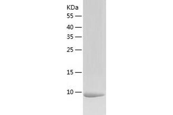 CAMK2N1 Protein (AA 1-78) (His tag)