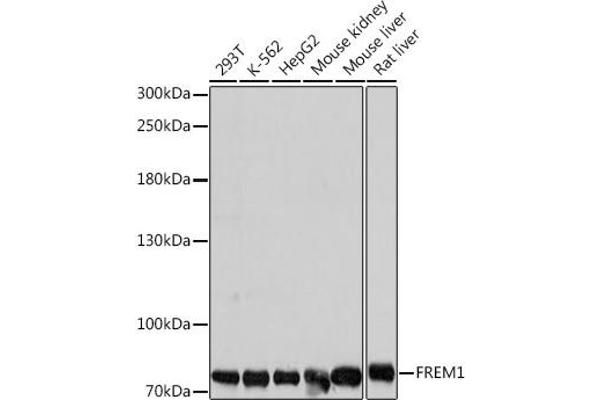 FREM1 抗体  (AA 1880-2179)