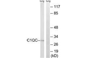 Western Blotting (WB) image for anti-Complement Component 1, Q Subcomponent, C Chain (C1QC) (AA 81-130) antibody (ABIN2890231) (C1QC 抗体  (AA 81-130))