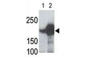 LRP5 antibody used in western blot to detect recombinant human LRP5 (Lane 1) and mouse LRP5 (2) proteins in transfected 293 cell lysate; Data is kindly provided by Drs. (LRP5 抗体  (AA 1538-1567))